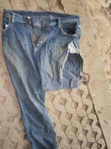 The jeans that Stle Lin Shwe was wearing on the motorbike. The missing leg was ripped up and shredded in the accident.